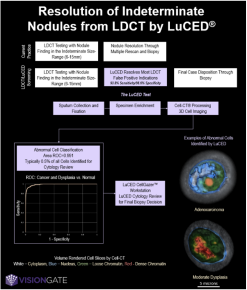 Resolution of Indeterminate Nodules