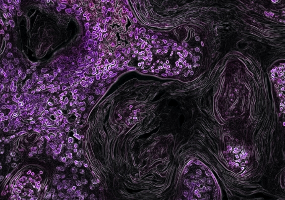 ai-powered-cancer-detection-1@2x